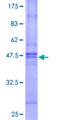 RABAC1 Protein - 12.5% SDS-PAGE of human RABAC1 stained with Coomassie Blue