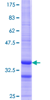 RABAC1 Protein - 12.5% SDS-PAGE Stained with Coomassie Blue.