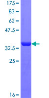 RABEP1 / Rabaptin-5 Protein - 12.5% SDS-PAGE Stained with Coomassie Blue.