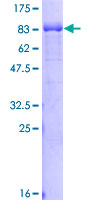 RABEP2 Protein - 12.5% SDS-PAGE of human RABEP2 stained with Coomassie Blue
