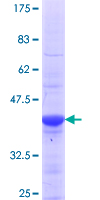 RABEPK / p40 Protein - 12.5% SDS-PAGE Stained with Coomassie Blue.