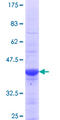RABEPK / p40 Protein - 12.5% SDS-PAGE Stained with Coomassie Blue.
