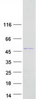 RABEPK / p40 Protein - Purified recombinant protein RABEPK was analyzed by SDS-PAGE gel and Coomassie Blue Staining
