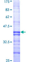 RABGAP1 Protein - 12.5% SDS-PAGE Stained with Coomassie Blue.