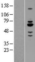 RABGEF1 Protein - Western validation with an anti-DDK antibody * L: Control HEK293 lysate R: Over-expression lysate