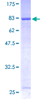 RABGEF1 Protein - 12.5% SDS-PAGE of human RABGEF1 stained with Coomassie Blue