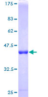 RABIF Protein - 12.5% SDS-PAGE of human RABIF stained with Coomassie Blue
