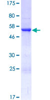 RABL2A Protein - 12.5% SDS-PAGE of human RABL2A stained with Coomassie Blue