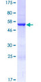 RABL2A Protein - 12.5% SDS-PAGE of human RABL2A stained with Coomassie Blue