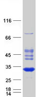 RABL2A Protein - Purified recombinant protein RABL2A was analyzed by SDS-PAGE gel and Coomassie Blue Staining