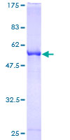 RABL2B Protein - 12.5% SDS-PAGE of human RABL2B stained with Coomassie Blue