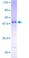 RABL3 Protein - 12.5% SDS-PAGE of human RABL3 stained with Coomassie Blue