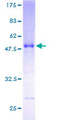 RABL3 Protein - 12.5% SDS-PAGE of human RABL3 stained with Coomassie Blue