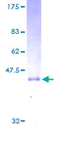 RAC1 Protein - 12.5% SDS-PAGE of human RAC1 stained with Coomassie Blue