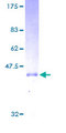 RAC1 Protein - 12.5% SDS-PAGE of human RAC1 stained with Coomassie Blue
