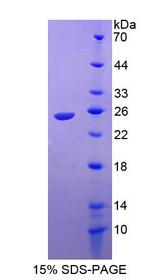 RAC1 Protein - Recombinant Ras Related C3 Botulinum Toxin Substrate 1 By SDS-PAGE
