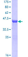 RAC2 Protein - 12.5% SDS-PAGE of human RAC2 stained with Coomassie Blue