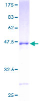 RAC3 Protein - 12.5% SDS-PAGE of human RAC3 stained with Coomassie Blue
