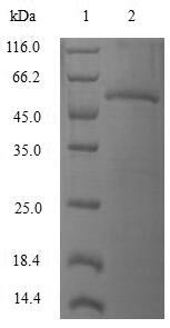 RAC3 Protein - (Tris-Glycine gel) Discontinuous SDS-PAGE (reduced) with 5% enrichment gel and 15% separation gel.