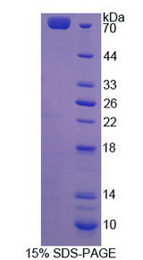 RACGAP1 / MGCRACGAP Protein - Recombinant Rac-GTPase Activating Protein 1 By SDS-PAGE