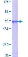 RAD1 Protein - 12.5% SDS-PAGE of human RAD1 stained with Coomassie Blue