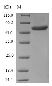 RAD1 Protein - (Tris-Glycine gel) Discontinuous SDS-PAGE (reduced) with 5% enrichment gel and 15% separation gel.