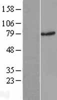 RAD17 Protein - Western validation with an anti-DDK antibody * L: Control HEK293 lysate R: Over-expression lysate