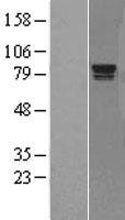 RAD17 Protein - Western validation with an anti-DDK antibody * L: Control HEK293 lysate R: Over-expression lysate