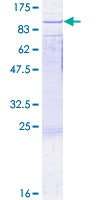 RAD17 Protein - 12.5% SDS-PAGE of human RAD17 stained with Coomassie Blue