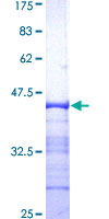 RAD17 Protein - 12.5% SDS-PAGE Stained with Coomassie Blue.