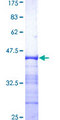 RAD17 Protein - 12.5% SDS-PAGE Stained with Coomassie Blue.