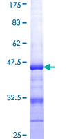 RAD18 Protein - 12.5% SDS-PAGE Stained with Coomassie Blue.