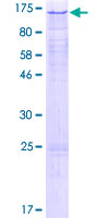 RAD21 Protein - 12.5% SDS-PAGE of human RAD21 stained with Coomassie Blue