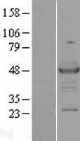 RAD23A / HHR23A Protein - Western validation with an anti-DDK antibody * L: Control HEK293 lysate R: Over-expression lysate
