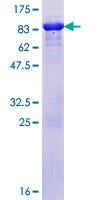 RAD23A / HHR23A Protein - 12.5% SDS-PAGE of human RAD23A stained with Coomassie Blue