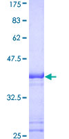 RAD23A / HHR23A Protein - 12.5% SDS-PAGE Stained with Coomassie Blue.