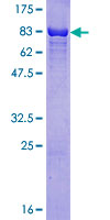 RAD23B / HR23B Protein - 12.5% SDS-PAGE of human RAD23B stained with Coomassie Blue
