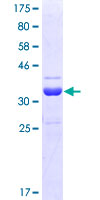 RAD23B / HR23B Protein - 12.5% SDS-PAGE Stained with Coomassie Blue.