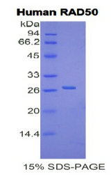 RAD50 Protein - Recombinant DNA Repair Protein RAD50 By SDS-PAGE