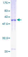 RAD51 / RECA Protein - 12.5% SDS-PAGE of human RAD51 stained with Coomassie Blue