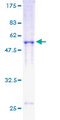 RAD51 / RECA Protein - 12.5% SDS-PAGE of human RAD51 stained with Coomassie Blue