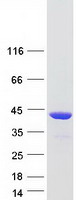 RAD51 / RECA Protein - Purified recombinant protein RAD51 was analyzed by SDS-PAGE gel and Coomassie Blue Staining