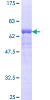 RAD51B Protein - 12.5% SDS-PAGE of human RAD51L1 stained with Coomassie Blue