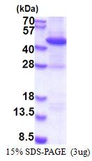 RAD51B Protein
