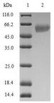 RAD51L3 / RAD51D Protein - (Tris-Glycine gel) Discontinuous SDS-PAGE (reduced) with 5% enrichment gel and 15% separation gel.