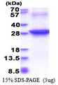 RAD51L3 / RAD51D Protein