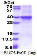 RAD51L3 / RAD51D Protein