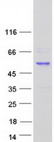 RAD52 Protein - Purified recombinant protein RAD52 was analyzed by SDS-PAGE gel and Coomassie Blue Staining