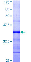 RAD54B Protein - 12.5% SDS-PAGE Stained with Coomassie Blue.