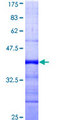 RAD54B Protein - 12.5% SDS-PAGE Stained with Coomassie Blue.